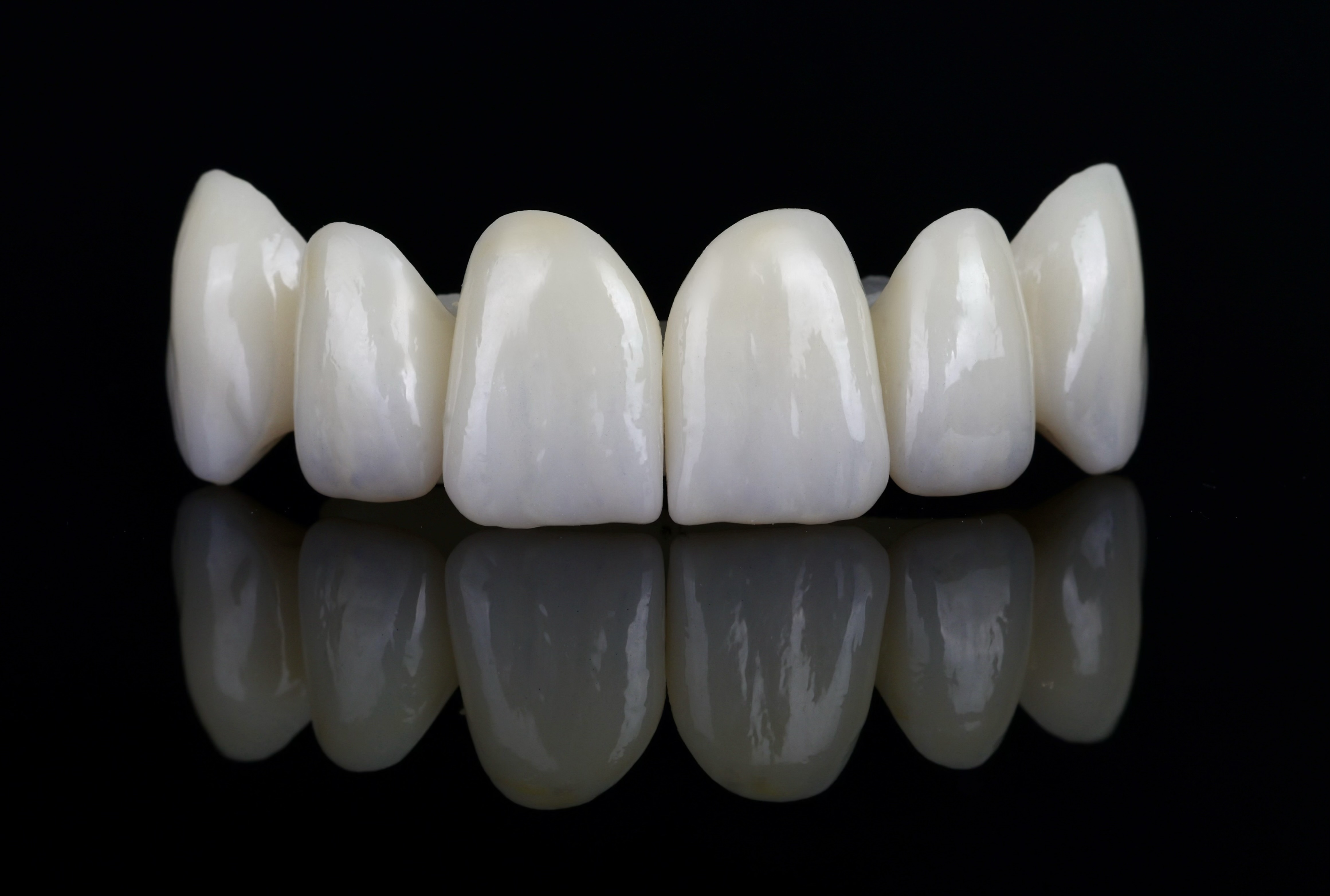 Aesthetic zirconia crowns
