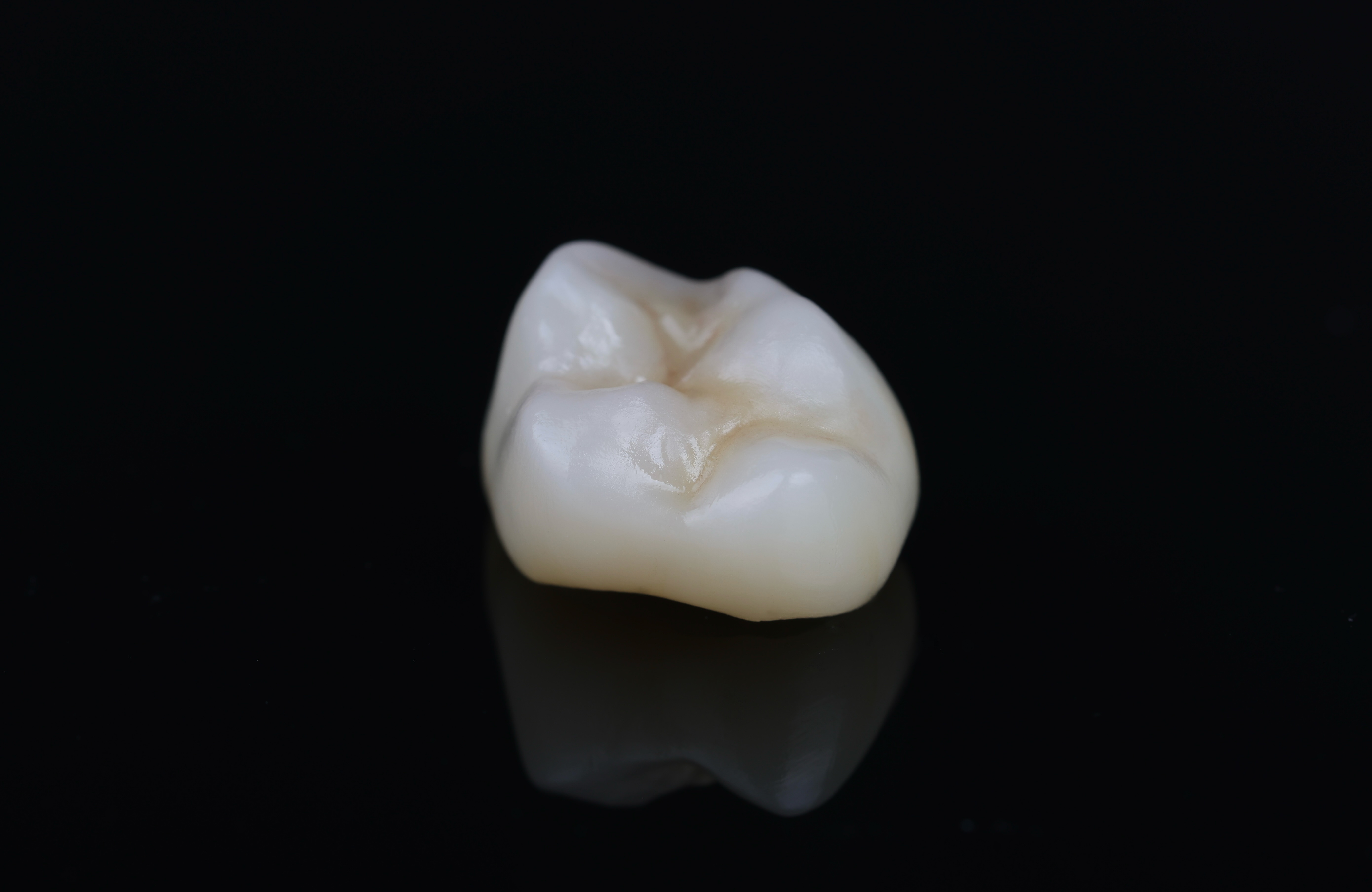Aesthetic zirconia crown — lateral view