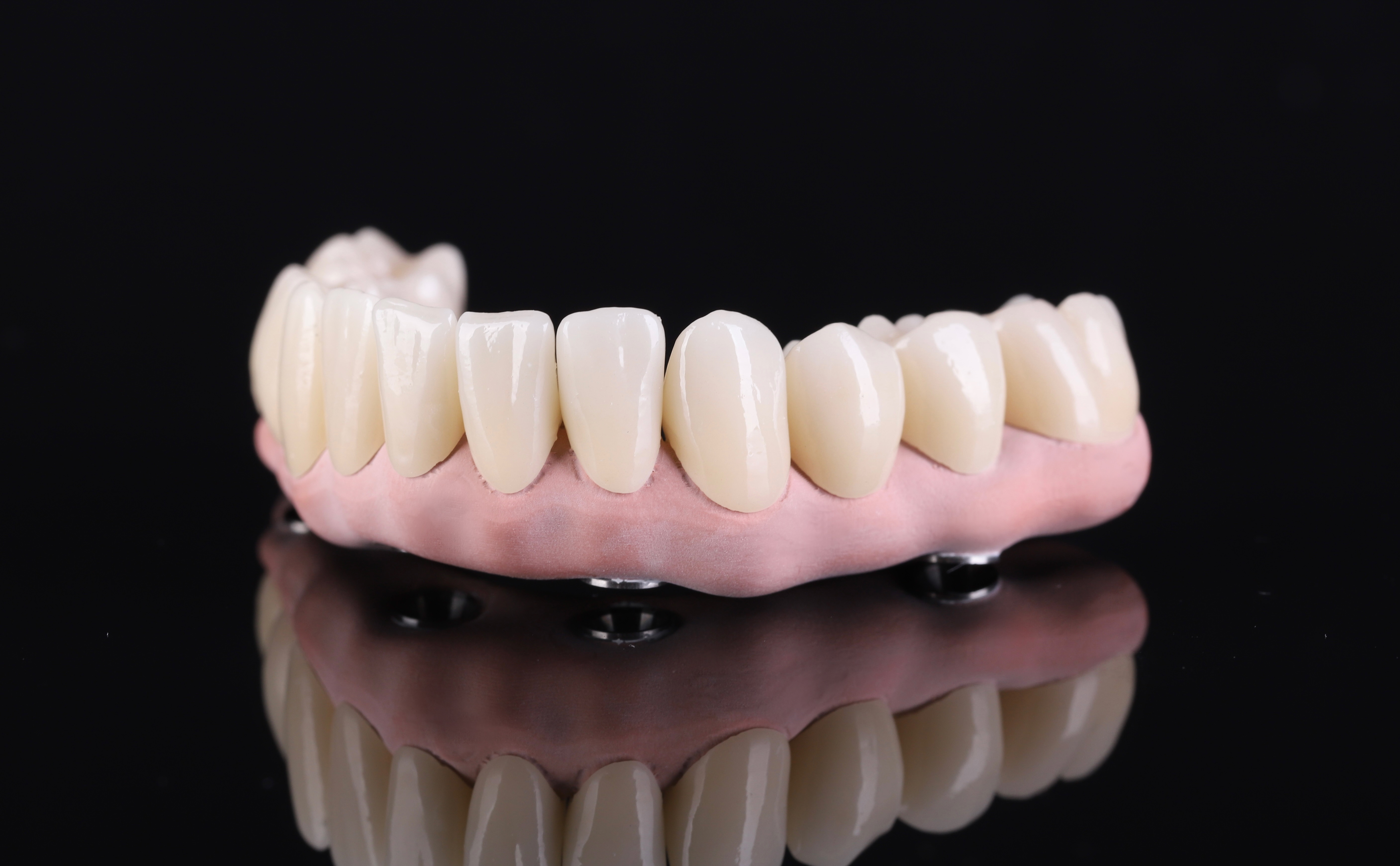 Dental restoration — Epic Dental Creations portfolio