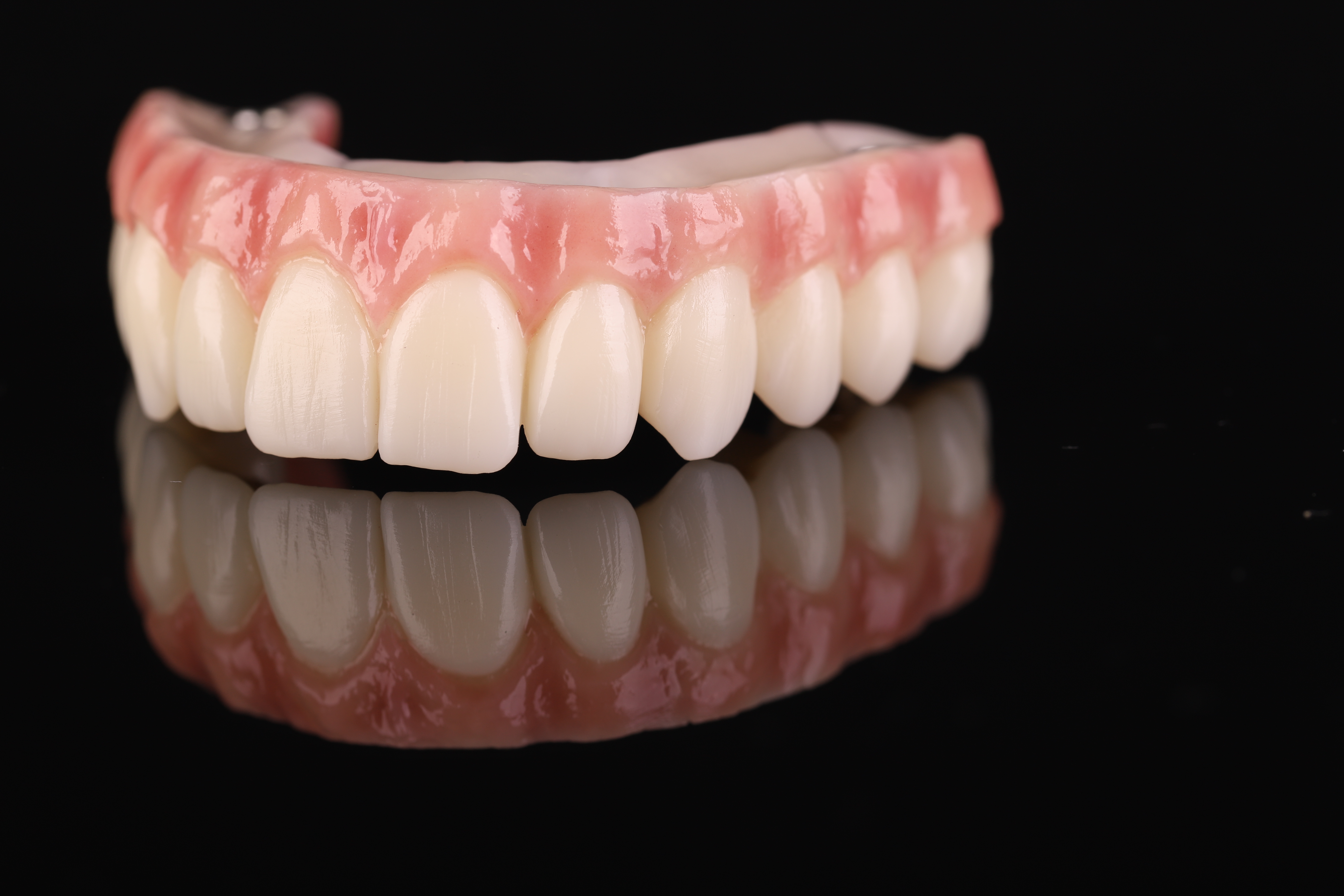 Dental restoration — Epic Dental Creations portfolio